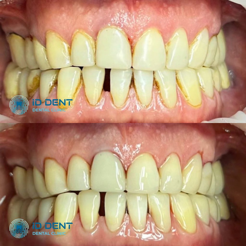 Médico dentista general; dentista higienista; periodoncista Serjovets Alina Serhiivna