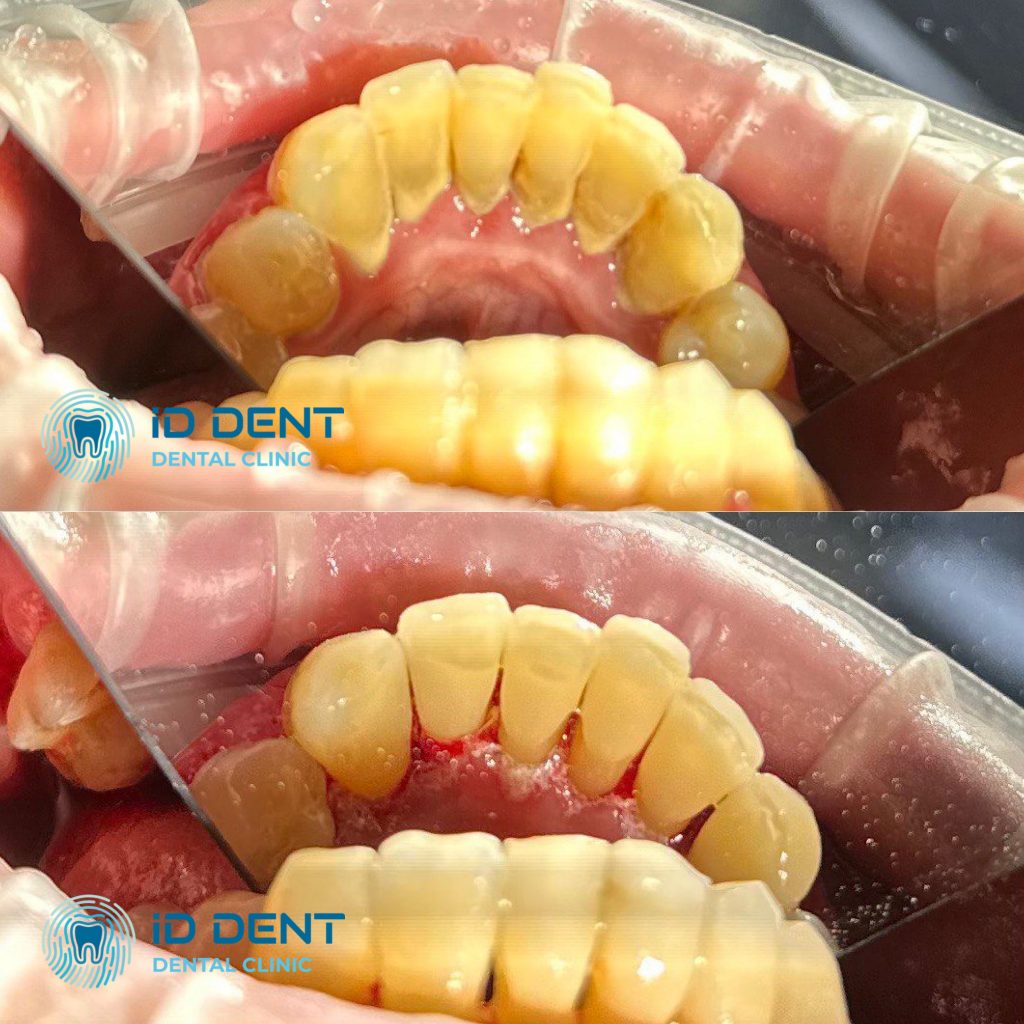 Médico dentista general; dentista higienista; periodoncista Serjovets Alina Serhiivna