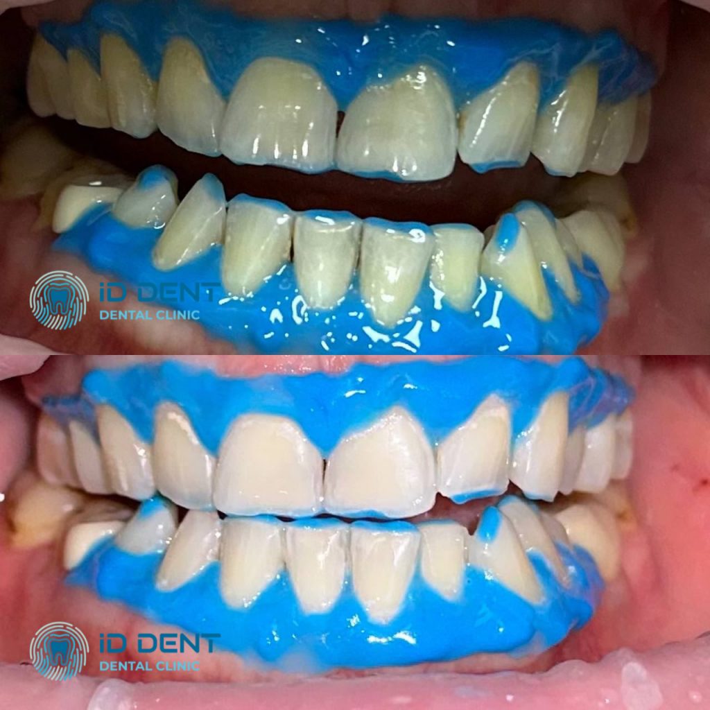 Médico dentista general; dentista higienista; periodoncista Serjovets Alina Serhiivna