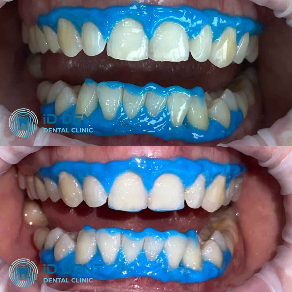 Médico dentista general; dentista higienista; periodoncista Serjovets Alina Serhiivna