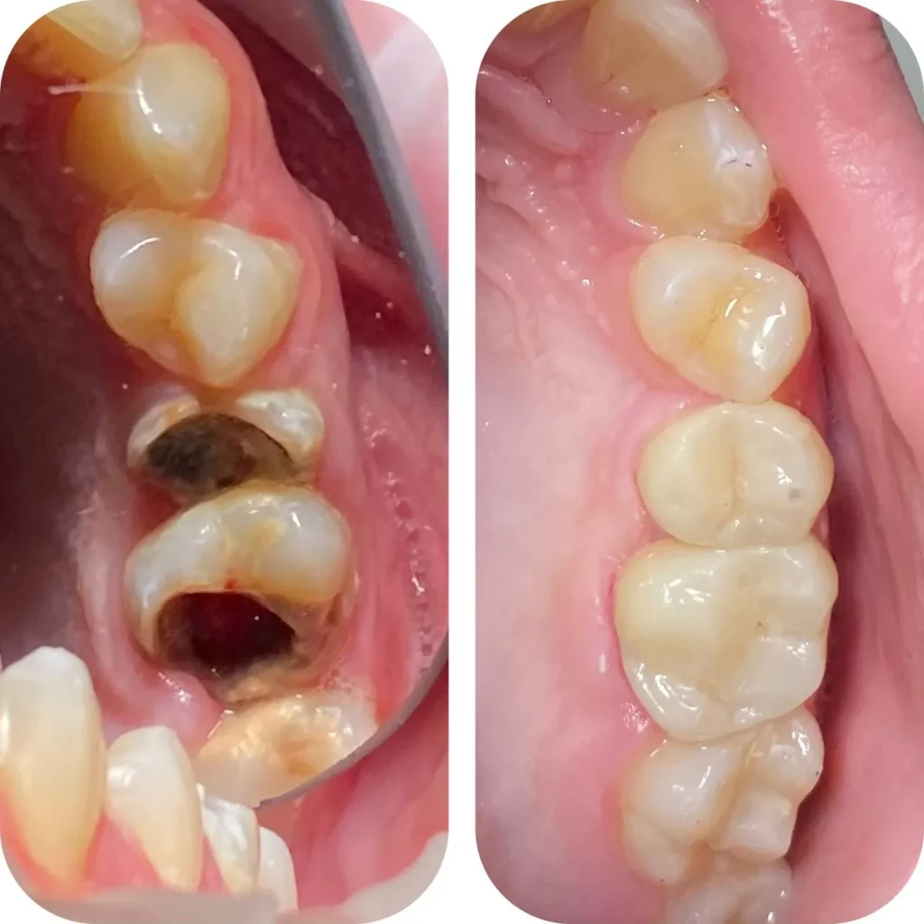 Dentista Serhii Myroslavovych Nahnybediuk