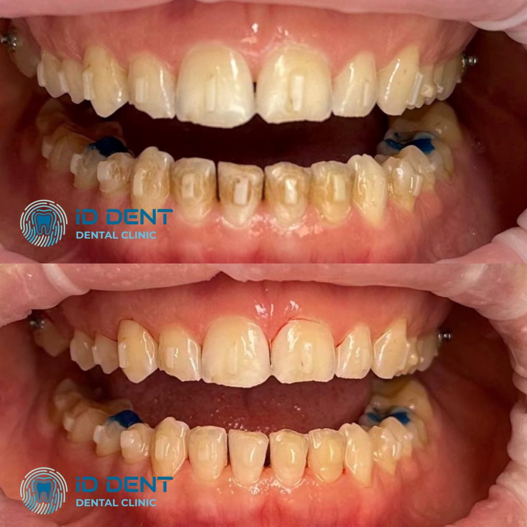 Médico dentista general; dentista higienista; periodoncista Serjovets Alina Serhiivna