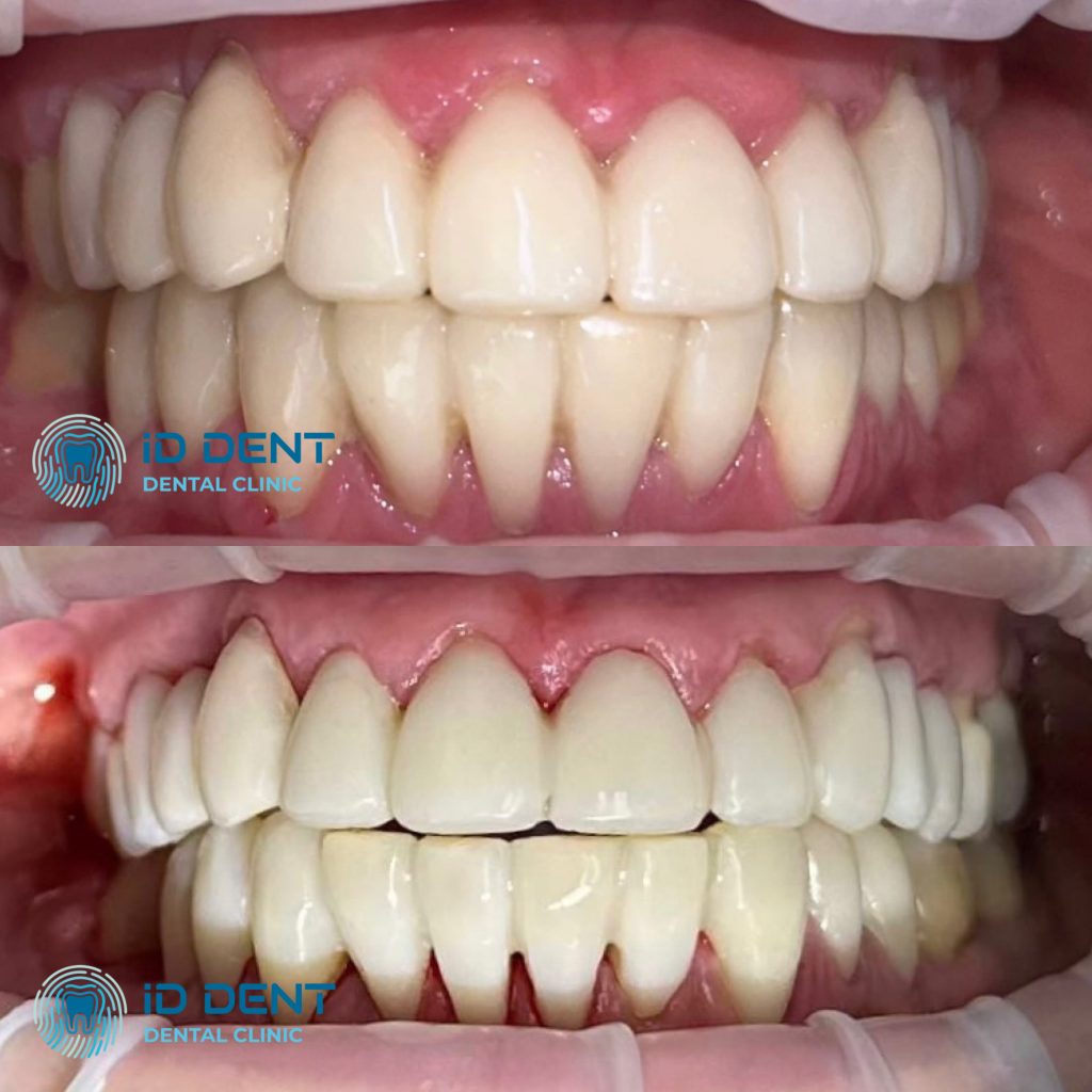 Médico dentista general; dentista higienista; periodoncista Serjovets Alina Serhiivna