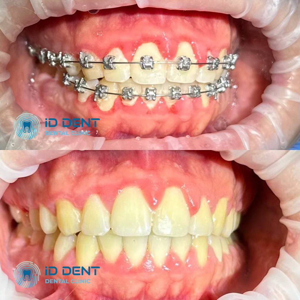 Médico dentista general; dentista higienista; periodoncista Serjovets Alina Serhiivna