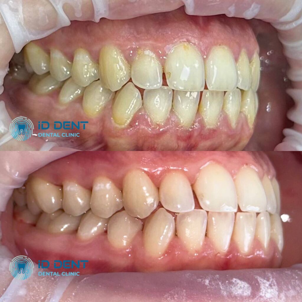 Médico dentista general; dentista higienista; periodoncista Serjovets Alina Serhiivna
