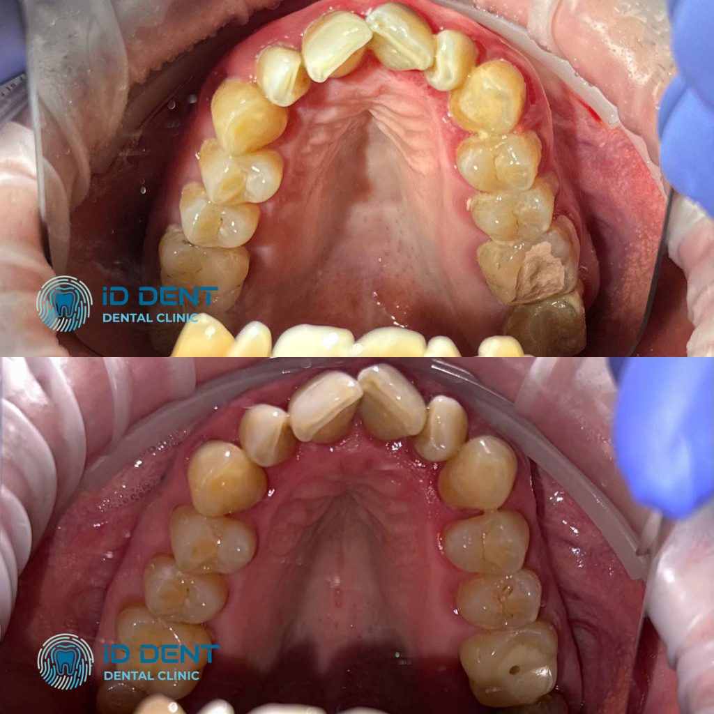 Médico dentista general; dentista higienista; periodoncista Serjovets Alina Serhiivna