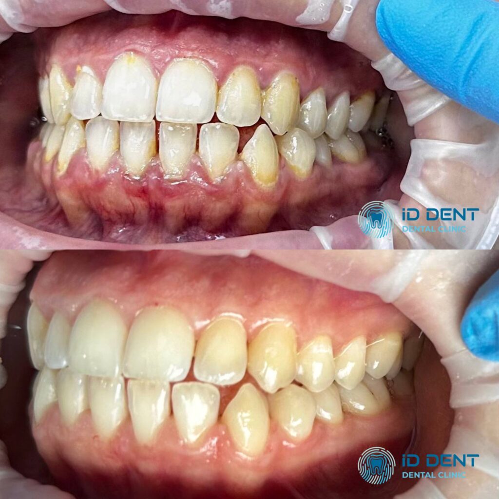 Médico dentista general; dentista higienista; periodoncista Serjovets Alina Serhiivna