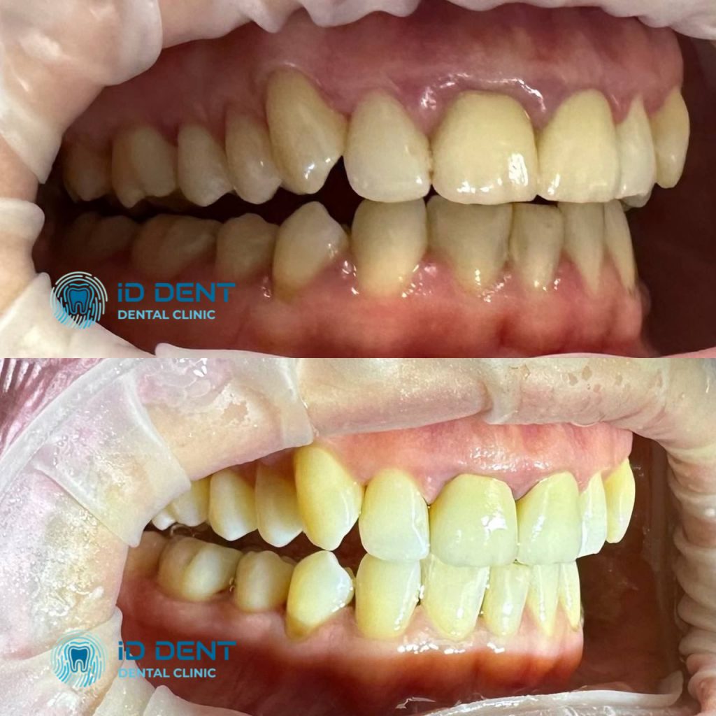 Médico dentista general; dentista higienista; periodoncista Serjovets Alina Serhiivna