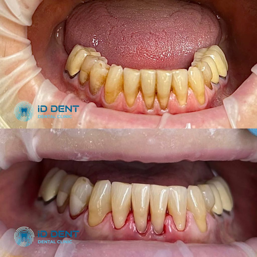Médico dentista general; dentista higienista; periodoncista Serjovets Alina Serhiivna