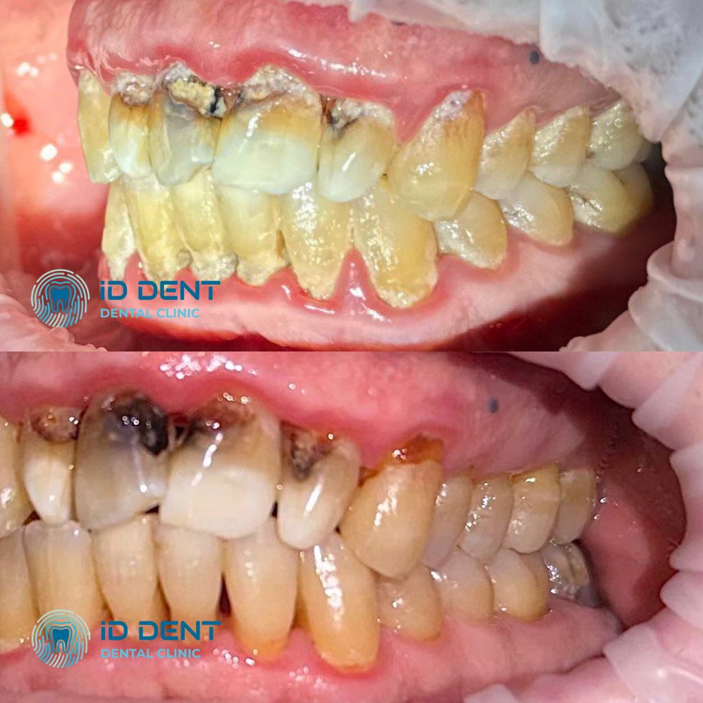 Médico dentista general; dentista higienista; periodoncista Serjovets Alina Serhiivna